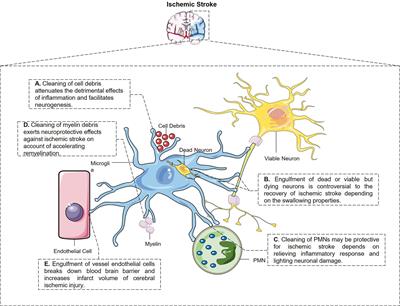 The Role of Microglial Phagocytosis in Ischemic Stroke